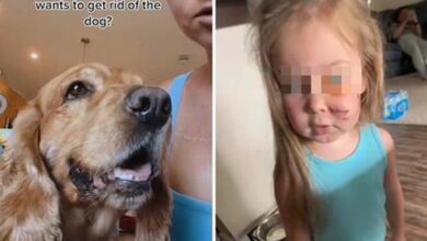 Photo of Mom responds to backlash after revealing she kept family dog that bit her daughter’s face
