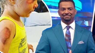 Photo of Alfonso Ribeiro Calls His Daughter ‘Brave’ After Suffering Scooter Accident Ahead of Her 4th Birthday