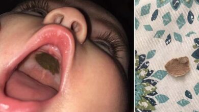 Photo of She saw a black spot in her daughter’s mouth and rushed her to the hospital