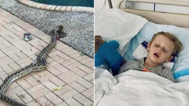 Photo of 4-Year-Old Boy ᴀᴛᴛᴀᴄᴋᴇᴅ By 15-Foot Python Which ʙɪᴛ His Leg And Tried To Drag Him From His House Twice