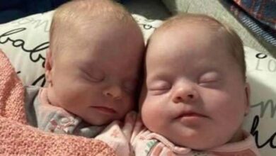 Photo of To silence critics, the mother of atypical Down syndrome twins displays how beautiful and precious they are.