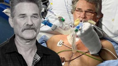 Photo of Kurt Russell had what medical conditions?
