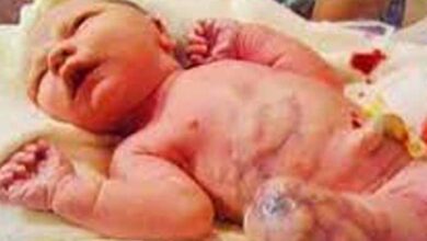 Photo of Mom Delivers Baby, Forbidden From Holding Him When Dad Utters: “There’s Something Wrong With Adam’s Leg”