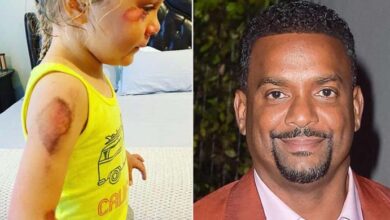 Photo of Before her fourth birthday, Alfonso Ribeiro calls his daughter “brave” when she has a scooter accident.