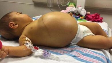 Photo of Little Braylee’s story shows how life-changing an organ donation can be