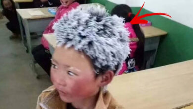 Photo of 8 Year Old Comes To School With Frozen Head When Teacher Looks Even Closer His Heart Breaks