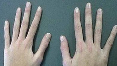 Photo of These Fingers Look Very Scary