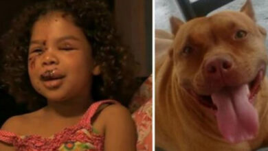 Photo of Neighbor’s labrador attacks 5-year-old – then the family pit bull does the forbidden