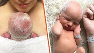 Photo of Baby Mocked For Having White Hair – But Wait Till You See How He Looks Years Later