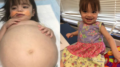 Photo of Little girl gets life-saving kidney operation thanks to her dad