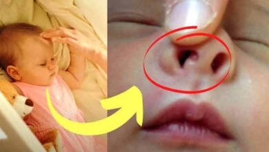 Photo of Mother Notices Holes in Baby’s Nose Doctors Discover Something Troubling