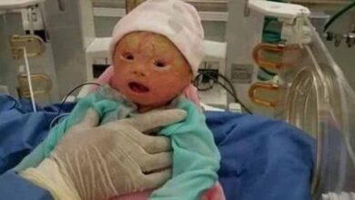 Photo of A  mother started screaming in the hospital when the doctor said “if you try to touch the baby, the baby will die”