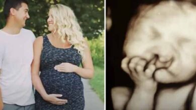 Photo of Parents Refuse To Abort Baby With ‘Deformity’ – Here’s How He Looks A Few Years Later