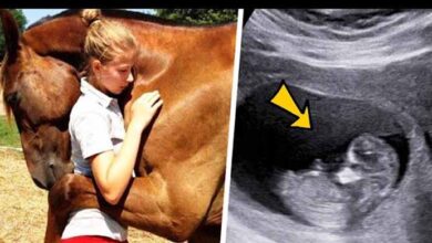 Photo of Horse Keeps Hugging Pregnant Woman – When Doctor Looks At Ultrasound He Calls The Police