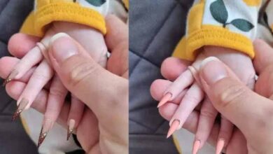 Photo of Mother Blasted Online After Sharing Photo Of Her Newborn’s Hands