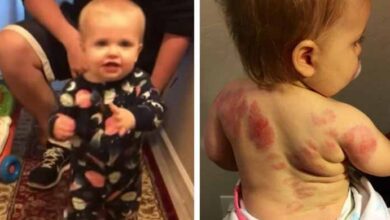 Photo of Parents Demand Answers After 1-yr-old Toddler Leaves Day Care Covered In Bloody Marks