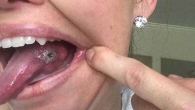 Photo of She THOUGHT she bit her Tongue while she was Asleep, but she Discovered Something UNBELIEVABLE
