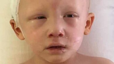 Photo of 4-yr-old boy is dying of cancer, then he opens his eyes and whispers 4 heartbreaking words