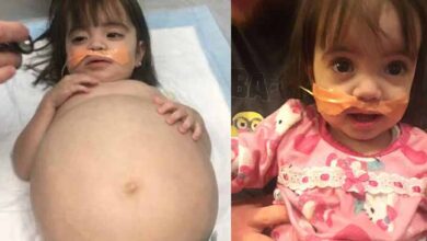 Photo of Dad performs a life-saving transplant on his daughter to save her.