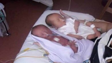 Photo of Couple expects identical twins — freeze when the doctor says “I’m sorry”