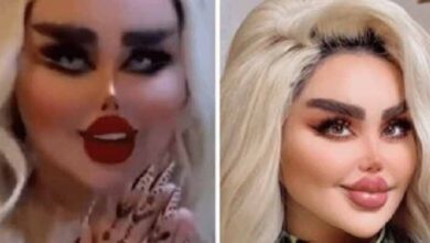 Photo of She Had 43 Cosmetic Procedures To Become A Barbie Doll – But Critics Say She Look Like A ‘Zombie’