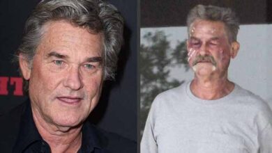 Photo of Kurt Russell had what medical conditions?