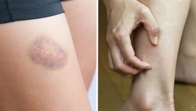 Photo of 10 Symptoms That Your Body Is Not Right