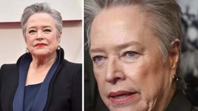 Photo of Veteran actress Kathy Bates diagnosed with serious chronic health condition