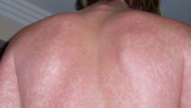 Photo of Symptoms and signs you shouldn’t ignore