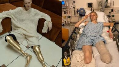 Photo of Woman Loses Her Legs Due To Common Household Product, Now She’s Warning Women Everywhere