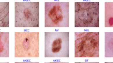 Photo of SERIOUS Diseases Diagnosed Via Skin Signals!