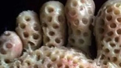 Photo of Trypophobia