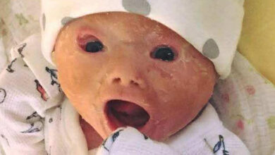 Photo of Mom shocked by her baby after birth,